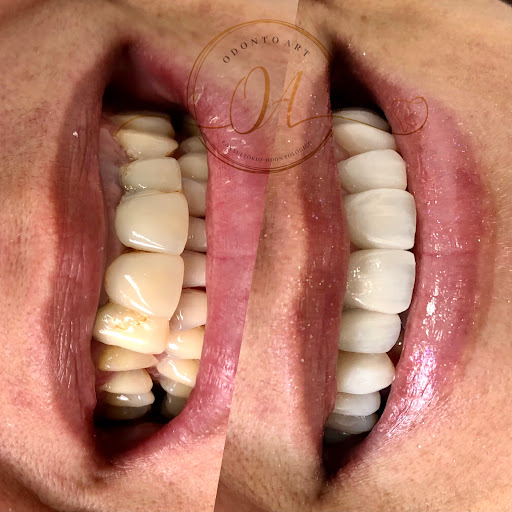 Dra. Bruna Sarquis - Odonto Art - Dentista em São Caetano - Dentista