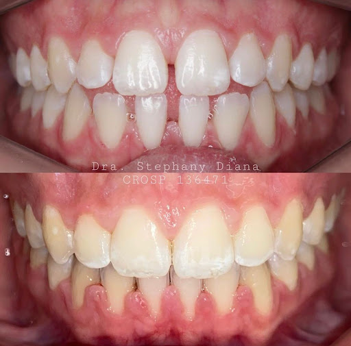 Dra Stephany G Diana - Dentista em São Caetano do Sul - Dentista